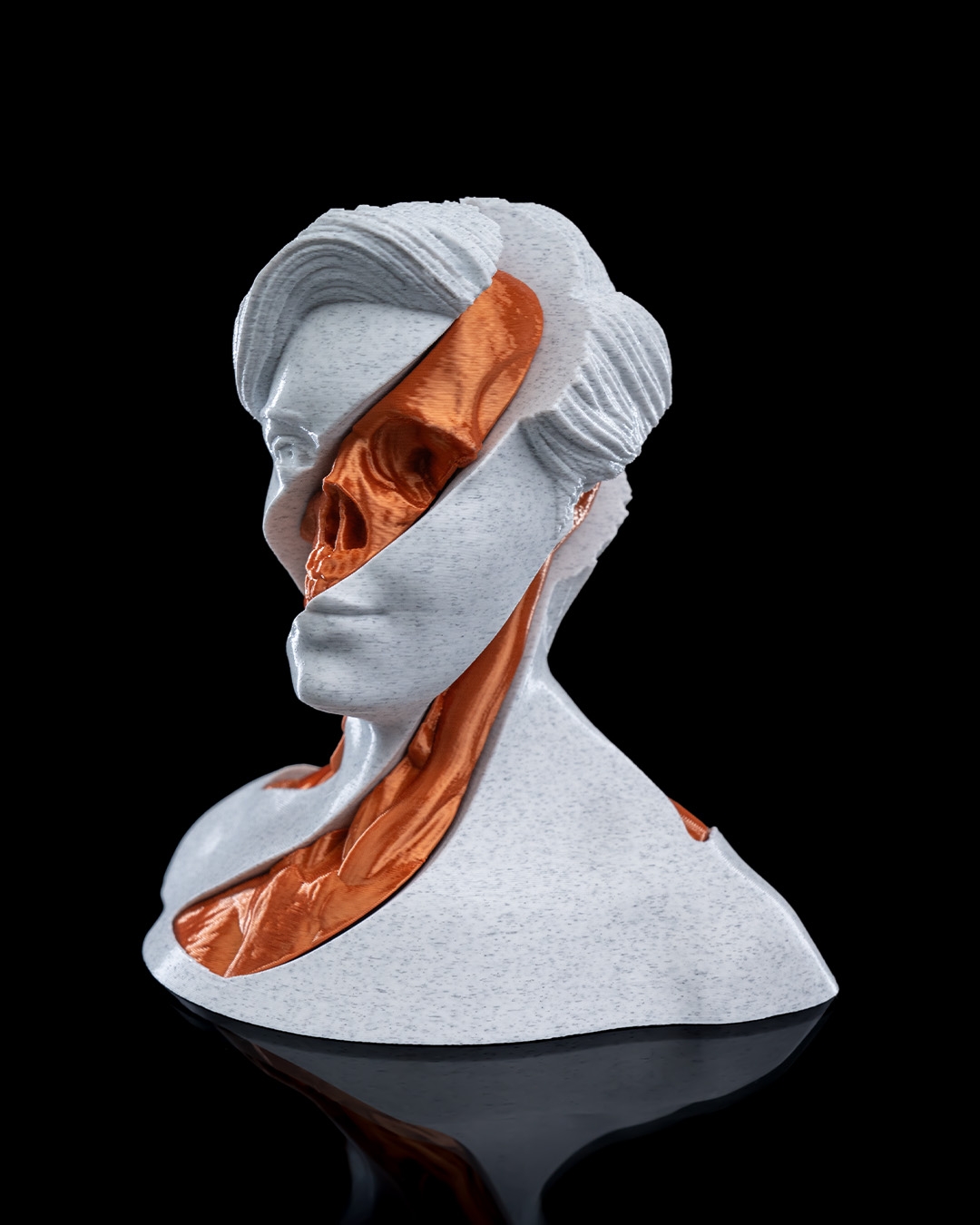 Whirls Anatomy - Image 5